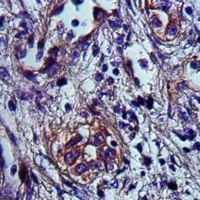 Frizzled 2 Rabbit Polyclonal Antibody