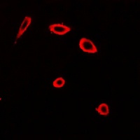 Frizzled 2 Rabbit Polyclonal Antibody