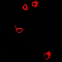 GPR106 Rabbit Polyclonal Antibody