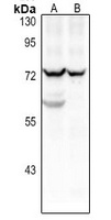 CD125 Antibody