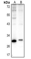 Carbonic Anhydrase 1 Rabbit Polyclonal Antibody