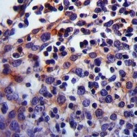 Carbonic Anhydrase 1 Rabbit Polyclonal Antibody