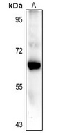 CARM1 Rabbit Polyclonal Antibody