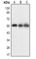 BACE1 (Acetyl-K316) Rabbit Polyclonal Antibody