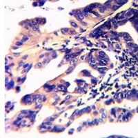 BACE1 (Acetyl-K316) Rabbit Polyclonal Antibody