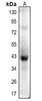 Actin-pan (Acetyl-K52/50/51) Rabbit Polyclonal Antibody