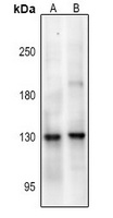 NMDAR1 (Phospho-S890) Rabbit Polyclonal Antibody