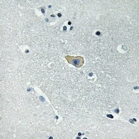 NMDAR1 (Phospho-S890) Rabbit Polyclonal Antibody