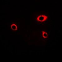 NMDAR1 (Phospho-S890) Rabbit Polyclonal Antibody