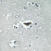 CDC25 (Phospho-S916) Rabbit Polyclonal Antibody