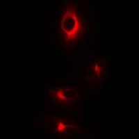 CDC25 (Phospho-S916) Rabbit Polyclonal Antibody