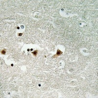 DNA-PKcs (Phospho-S2612) Rabbit Polyclonal Antibody