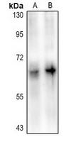 DAB1 (Phospho-Y220) Rabbit Polyclonal Antibody