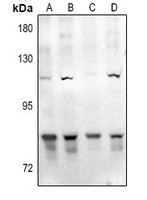 GAB2 Rabbit Polyclonal Antibody