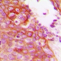 GAB2 Rabbit Polyclonal Antibody