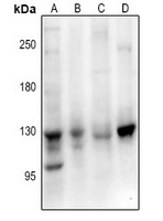 EPHB1/2/3 Rabbit Polyclonal Antibody