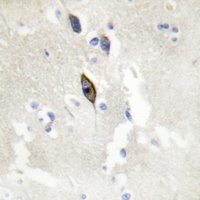 EPHB1/2/3 Rabbit Polyclonal Antibody