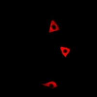 EPHB1/2/3 Rabbit Polyclonal Antibody