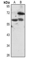 BS69 Rabbit Polyclonal Antibody