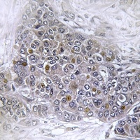 BS69 Rabbit Polyclonal Antibody