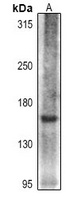 Collagen 16 alpha 1 Rabbit Polyclonal Antibody