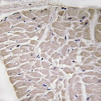 Collagen 16 alpha 1 Rabbit Polyclonal Antibody