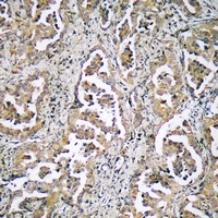 ADAMTS17 Rabbit Polyclonal Antibody