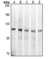 Topoisomerase 1 Rabbit Polyclonal Antibody