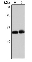 CCL2 Antibody