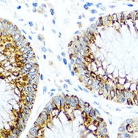 CCL2 Antibody
