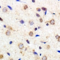 Laminin gamma 1 Rabbit Polyclonal Antibody