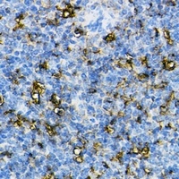 NLRP3 Rabbit Polyclonal Antibody