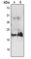 CD3e Antibody