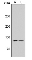 CD289 Rabbit Polyclonal Antibody