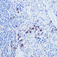 CD289 Rabbit Polyclonal Antibody