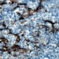 IL-6 Antibody