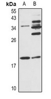 JDP2 Rabbit Polyclonal Antibody
