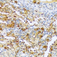 ACF Rabbit Polyclonal Antibody
