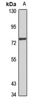 ABCG8 Rabbit Polyclonal Antibody