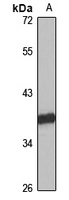 ABHD5 Rabbit Polyclonal Antibody