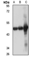 ACAA2 Rabbit Polyclonal Antibody
