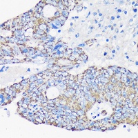ACAA2 Rabbit Polyclonal Antibody