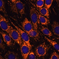ACAA2 Rabbit Polyclonal Antibody
