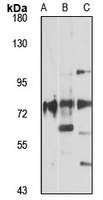 ACSL1 Rabbit Polyclonal Antibody