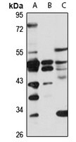 ACTL8 Rabbit Polyclonal Antibody