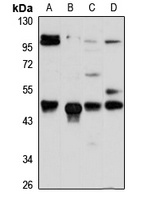 ACTR6 Antibody