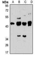 ARPM1 Rabbit Polyclonal Antibody