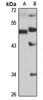 ACVR1 Antibody