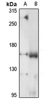 ADAMTS13 Rabbit Polyclonal Antibody