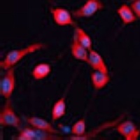 ADAMTS13 Rabbit Polyclonal Antibody